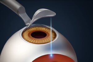 What Are Flap-Based Surgeries
