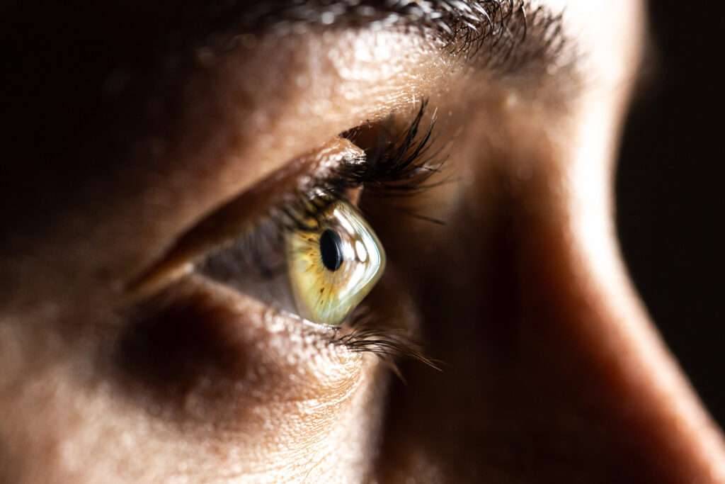 What Causes Thin Corneas