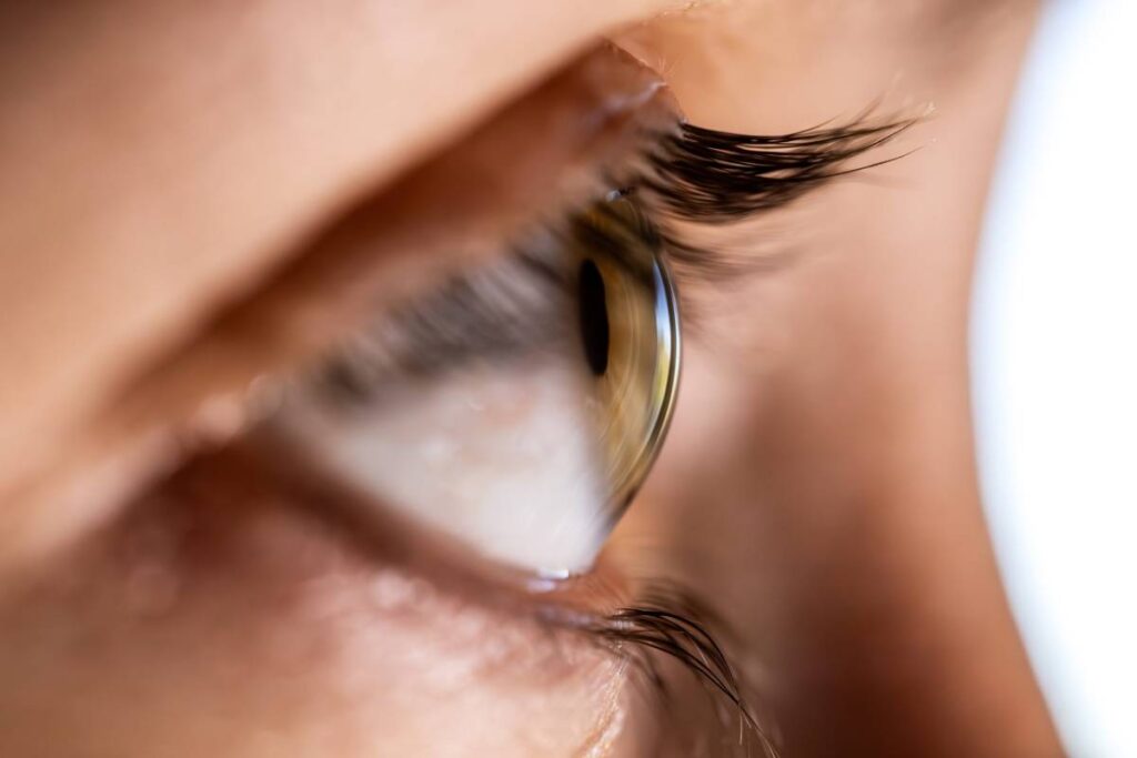What Does It Mean to Have Thin Corneas