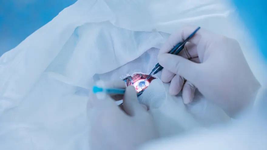 What is Standard LASIK and How Does it Work