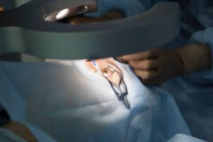 What Is Traditional Cataract Surgery