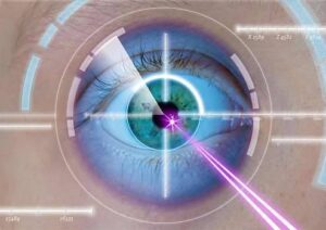 What is CLEAR Neo Eye Surgery