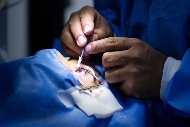 How to Avail Cashless Eye Treatment at Eye Mantra