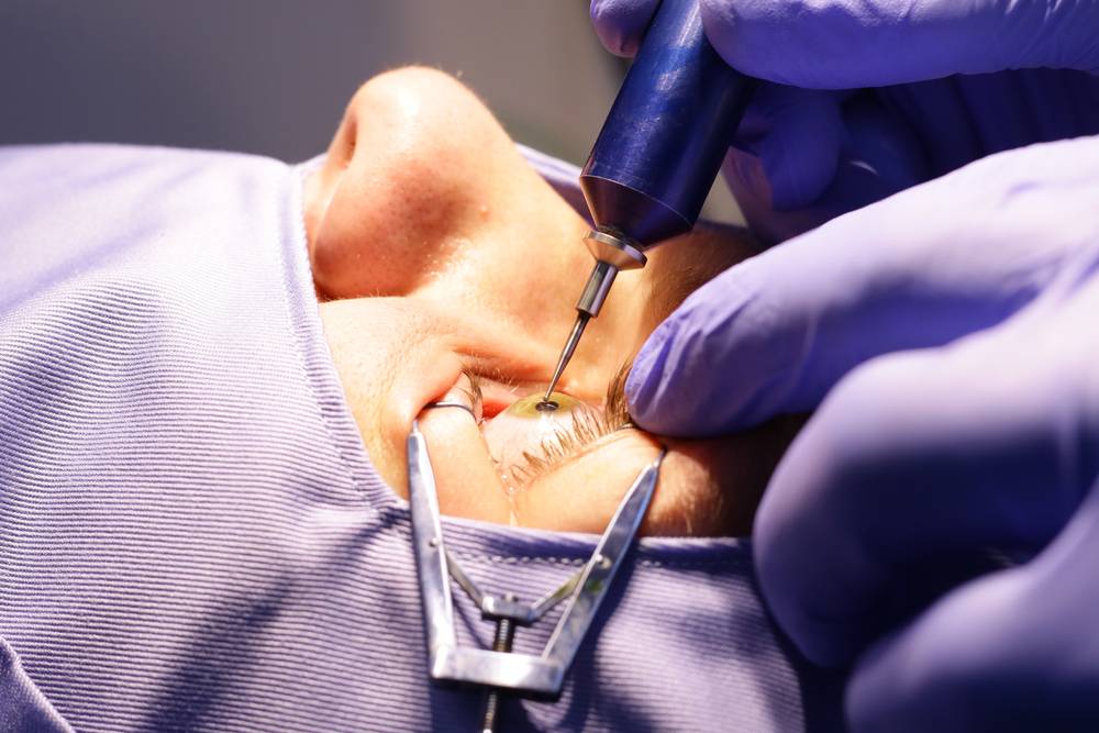 What Eye Treatments Are Available at Eye Mantra in Gurugram
