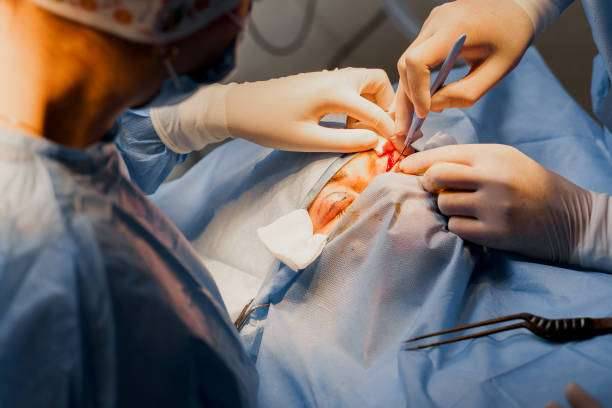 What Is Corneal Cross-Linking (C3R) Treatment
